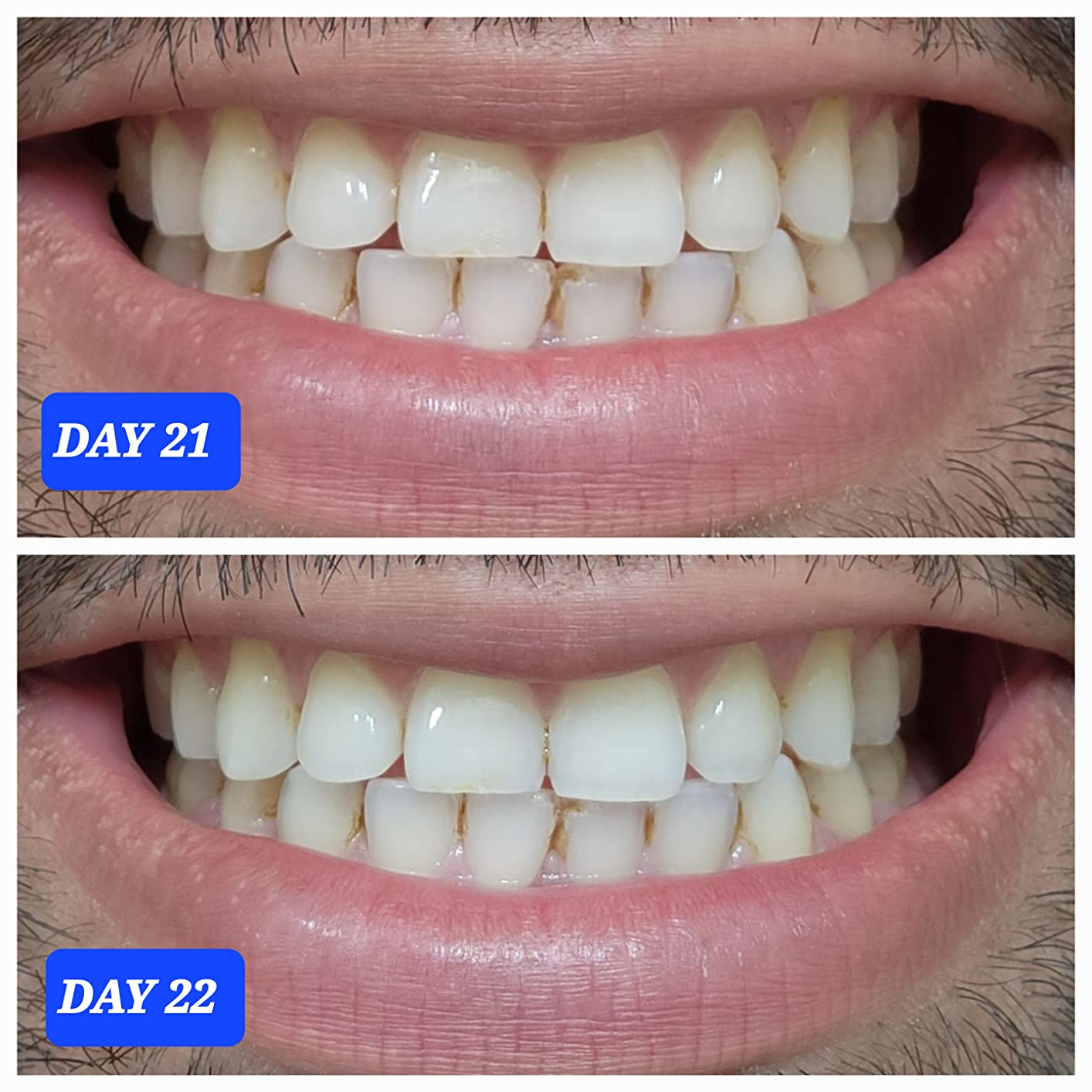 Crest 3D Whitestrips Professional Effects - Teeth Whitening Kit, 22 Treatments (20 + 2 Bonus), Each with 1 Upper/1Lower, 44 Strips customer photo 1