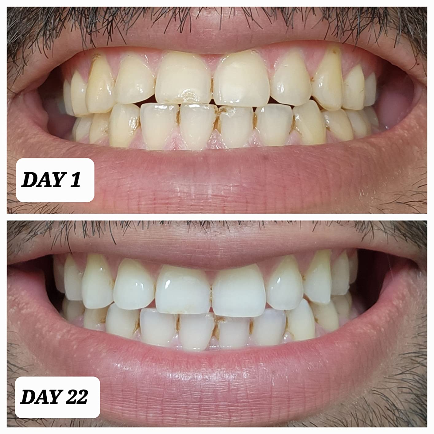 Crest 3D Whitestrips Professional Effects - Teeth Whitening Kit, 22 Treatments (20 + 2 Bonus), Each with 1 Upper/1Lower, 44 Strips customer photo 2