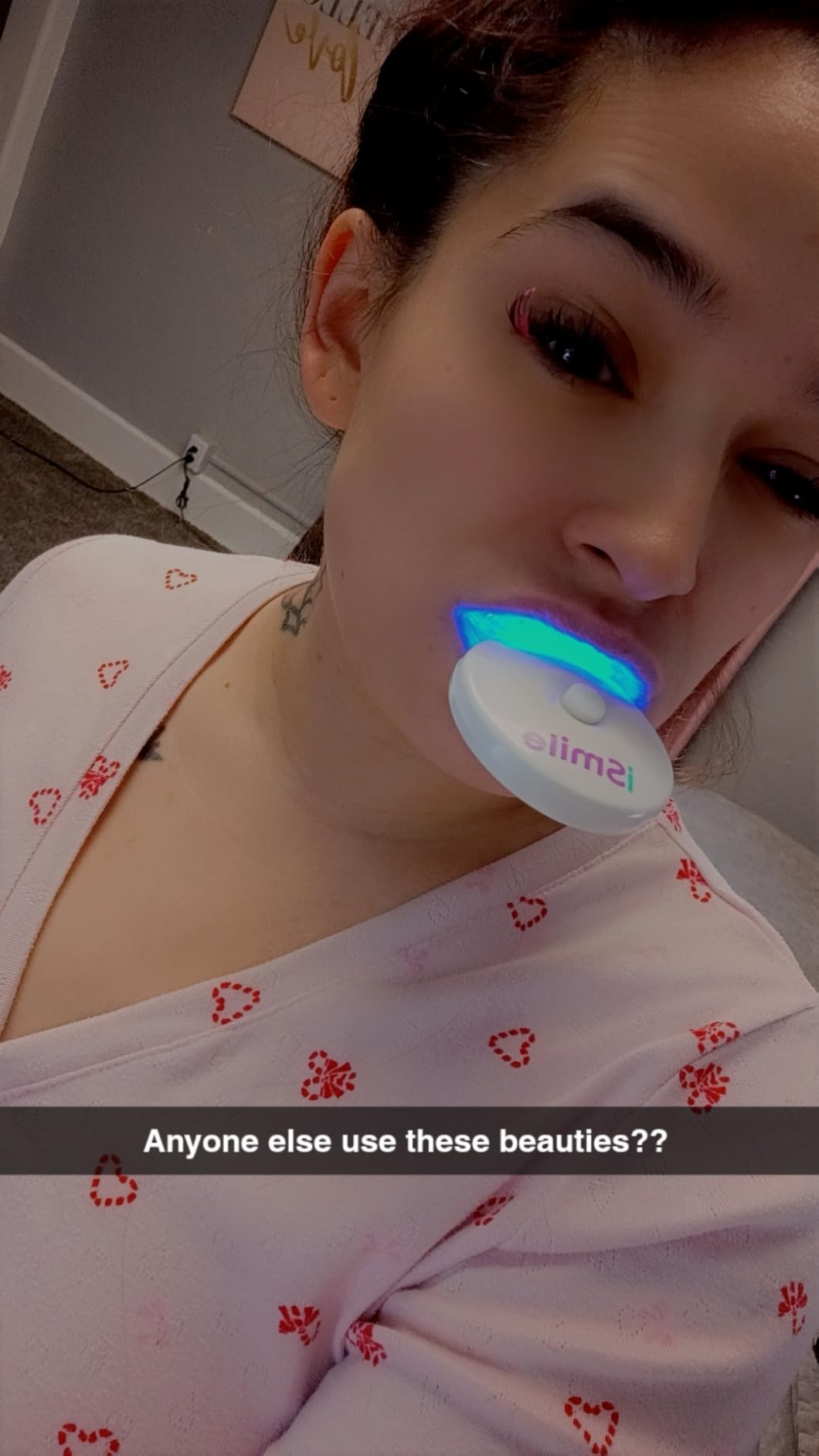 iSmile Teeth Whitening Kit - LED Light, 35% Carbamide Peroxide, (3) 3ml Gel Syringes, (1) Remineralization Gel, and Tray customer photo 1