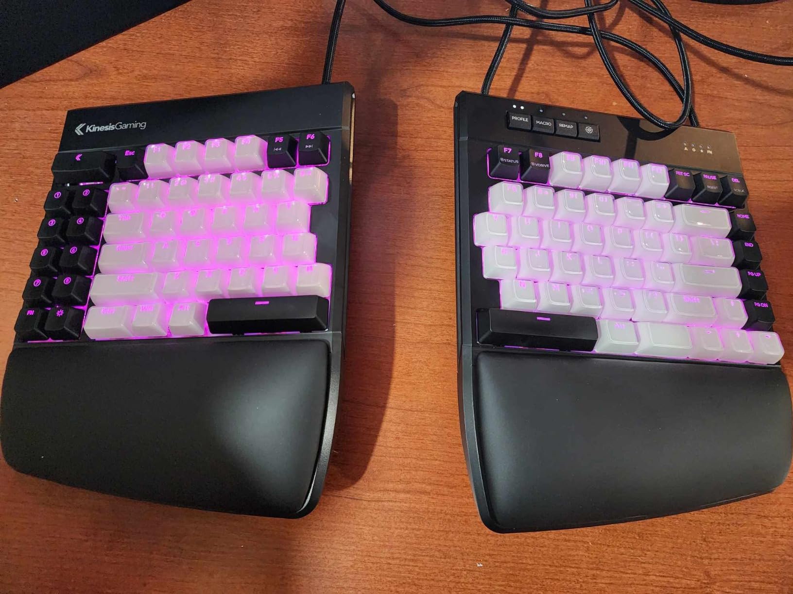KINESIS Gaming Freestyle Edge RGB Split Mechanical Keyboard | Cherry MX Linear Red Switches | RGB | Ergonomic | Detachable Palm Support | Fully Programmable | TKL | Available Tenting customer photo 1
