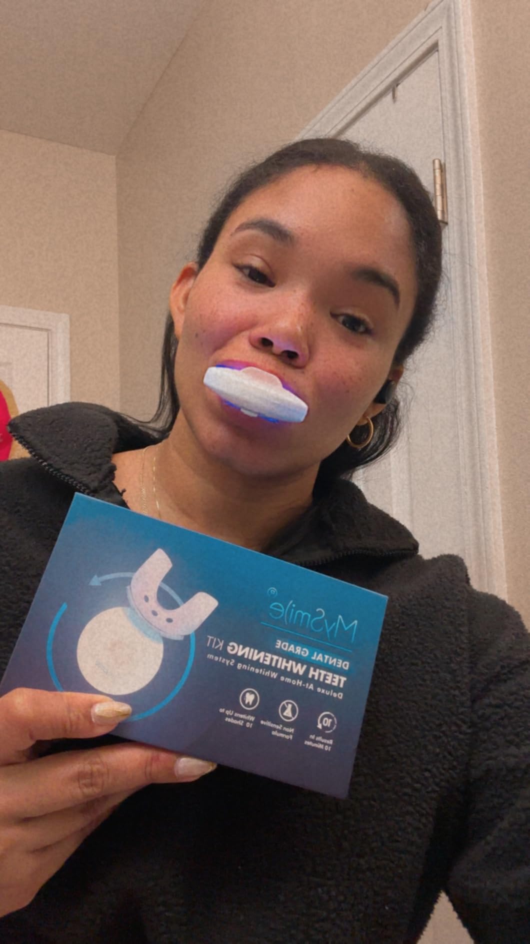 MySmile Teeth Whitening Kit with LED Light, 10 Min Non-Sensitive Fast Teeth Whitener with 3 Carbamide Peroxide Whitening Gel customer photo 2