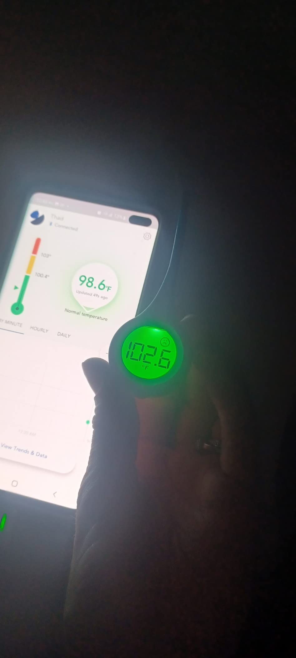 Masimo Radius T° Wearable Digital Thermometer, Continuous Monitoring of Fever 24x7, Medical Grade Accuracy, 3 Temperature Sensors, Water-Resistant, Free Smart App Alerts on Android/iOS customer photo 1