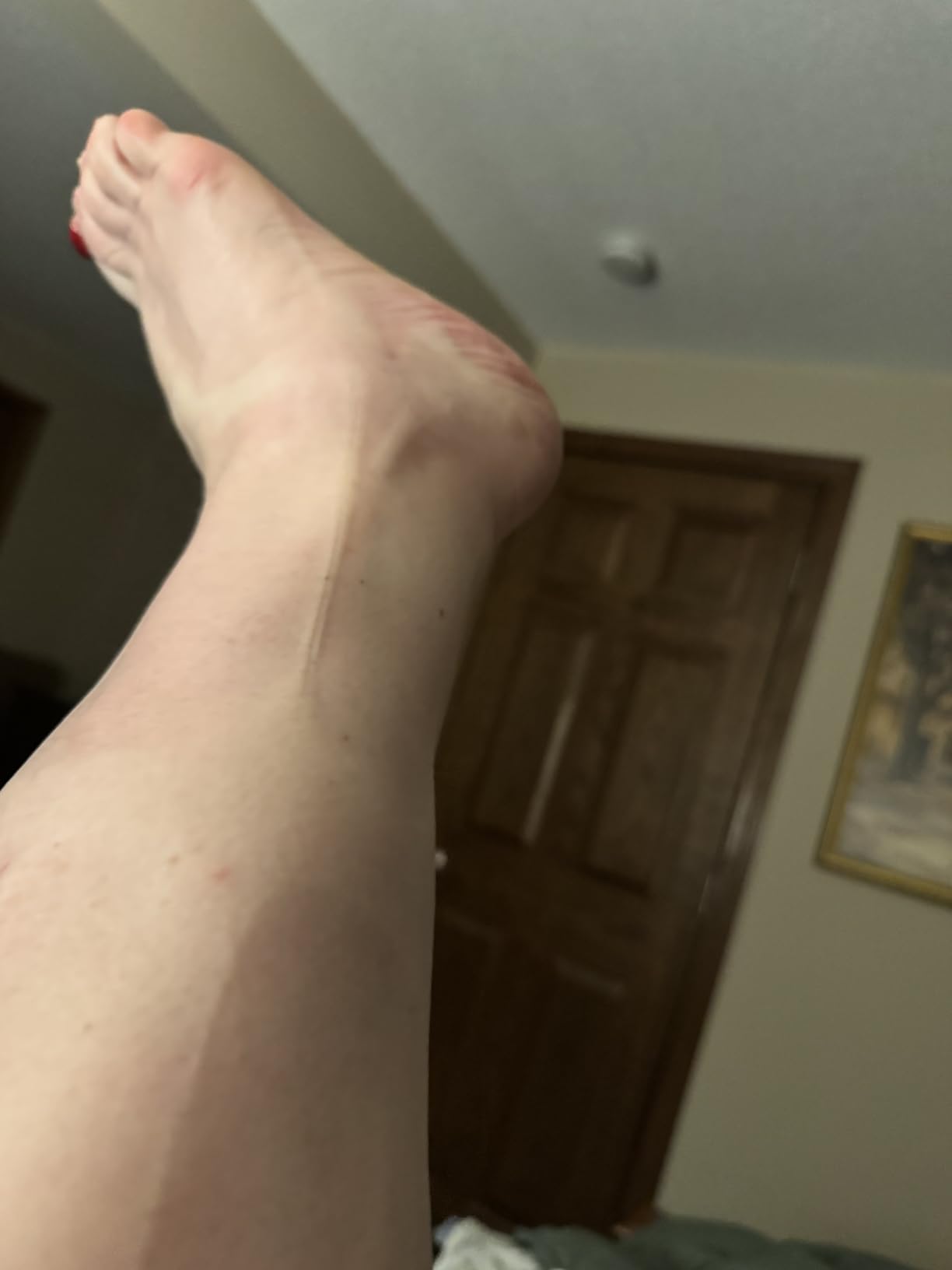 FIT KING Air Compression Leg Massager with Heat and Compression for Circulation and Pain Relief, Full Leg & Foot Massager for Swelling Edema RLS with Pressure Sensor LCD Display customer photo 2