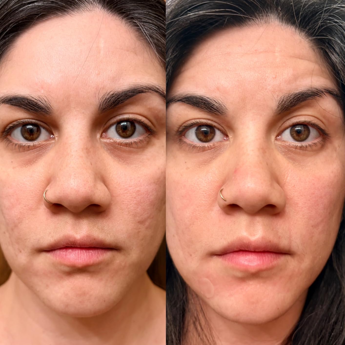 LifePro Red Light Therapy for Body Panel - 90 & 120 Dual Chip LEDs - 660nm & 850nm Near Infrared Full Body Red light Therapy Panel - For Daily Wellness & Comfort -Includes Hanging Kit and Eyewear customer photo 1