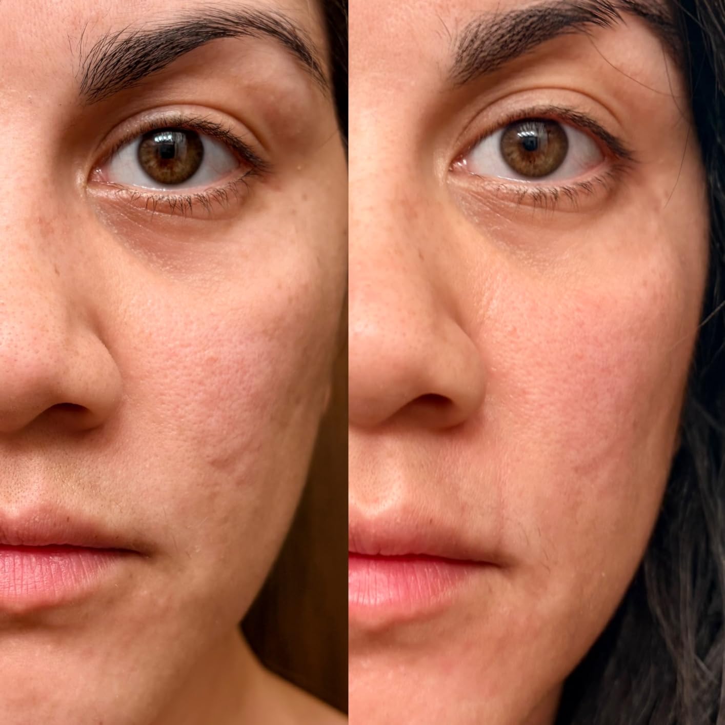 LifePro Red Light Therapy for Body Panel - 90 & 120 Dual Chip LEDs - 660nm & 850nm Near Infrared Full Body Red light Therapy Panel - For Daily Wellness & Comfort -Includes Hanging Kit and Eyewear customer photo 2