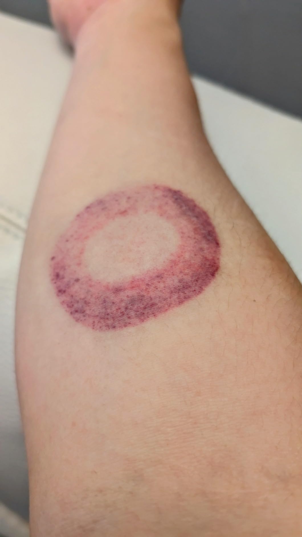 Therabody TheraCup - Portable Cupping Massage Therapy for Localized Muscle Tension Relief & Blood Circulation in Back, Shoulders, Legs and Body - Smart Cupping Therapy with ThermaVibration Technology customer photo 1