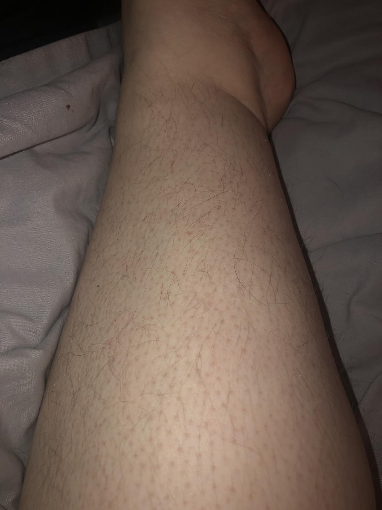 Philips SatinShave Essential Women's Wet & Dry Electric Shaver for Legs & Body, Cordless, with Hypoallergenic Foil, HP6306/50 customer photo 1
