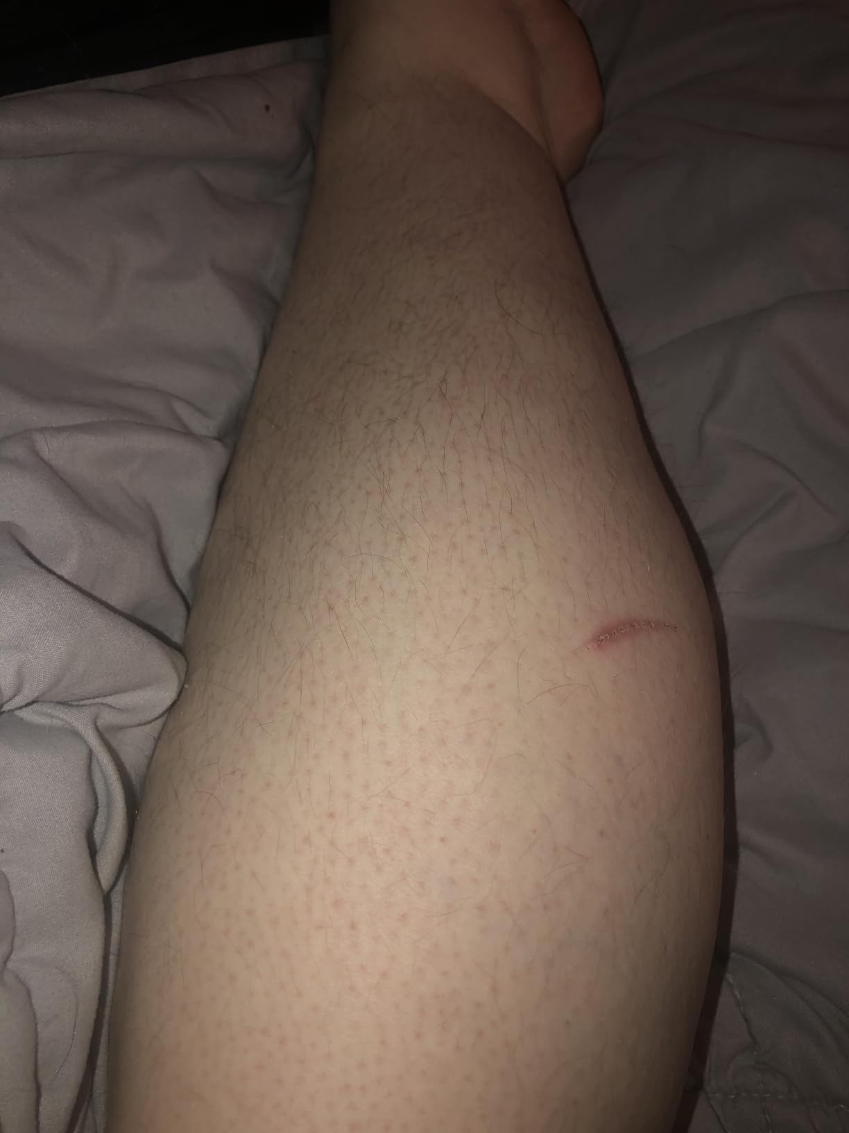 Philips SatinShave Essential Women's Wet & Dry Electric Shaver for Legs & Body, Cordless, with Hypoallergenic Foil, HP6306/50 customer photo 2