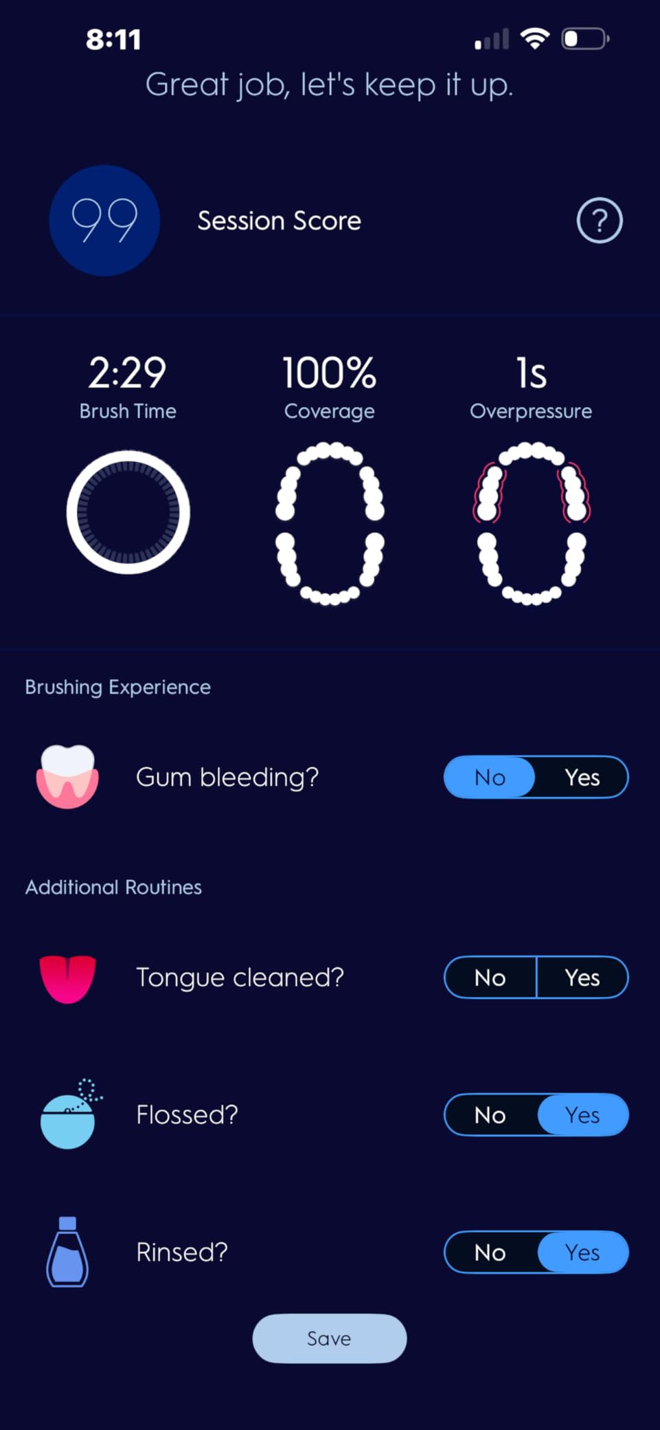 Genius X Limited Rechargeable Electric Toothbrush with 1 Replacement Brush Head, Travel Case, White customer photo 2