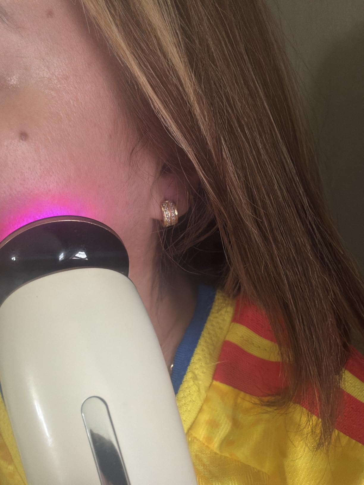 INIA 3-in-1 Red Light Therapy for Face and Neck Beauty Device for Puffiness & Skin Firming Skincare Tool customer photo 1