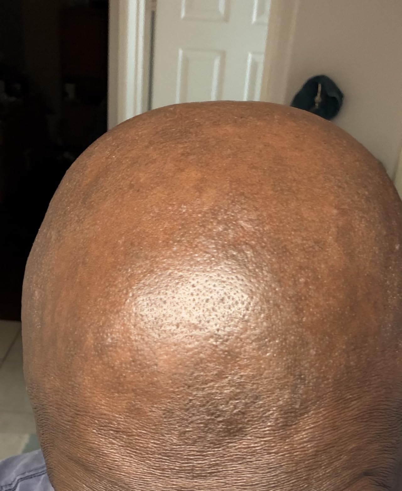 Philips Norelco Head Shaver Pro 9000 Series - Electric Shaver for Men and Women, 360-Degree Flexing Head and ComfortCut Blades for Clean Shave, Gentle on Skin, Model HS9980/40 customer photo 2