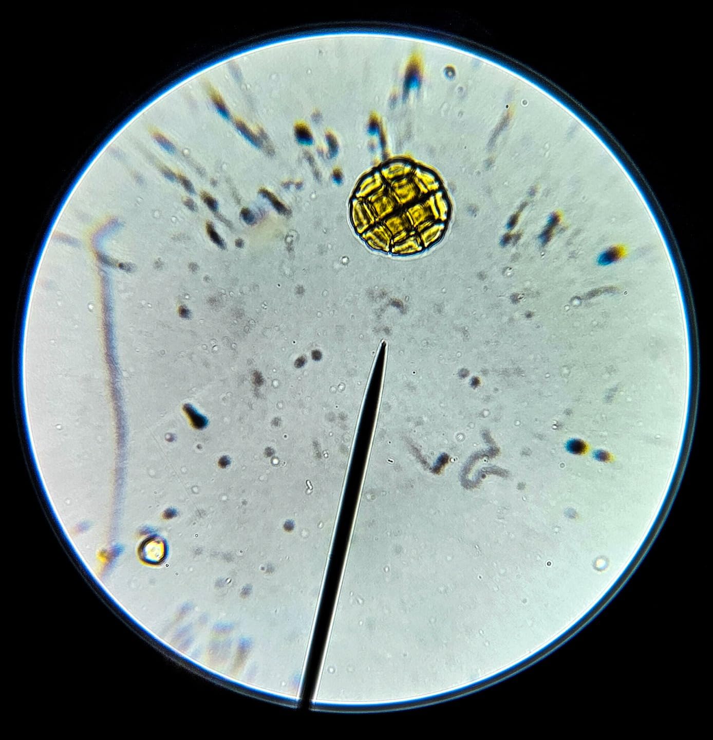 AmScope M150C 40X-1000X All-Metal Optical Glass Lenses Cordless LED Compound Biological Microscope customer photo 1