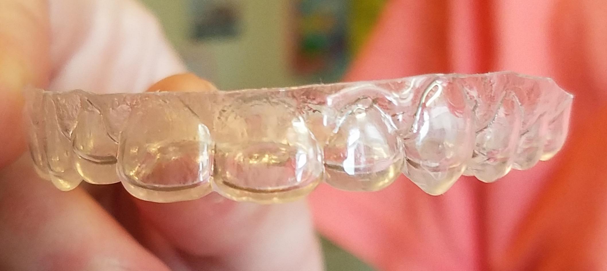 iSonic F3900 Ultrasonic Denture/Aligner/Retainer Cleaner for All Dental appliances (Machine Only) customer photo 2