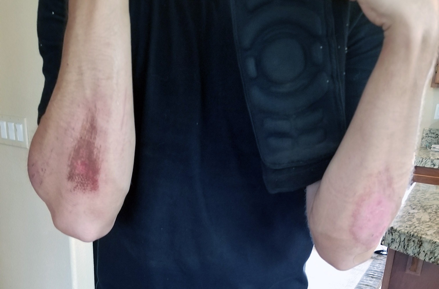 Bodyprox Elbow Protection Pads 1 Pair, Elbow Guard Sleeve customer photo 1