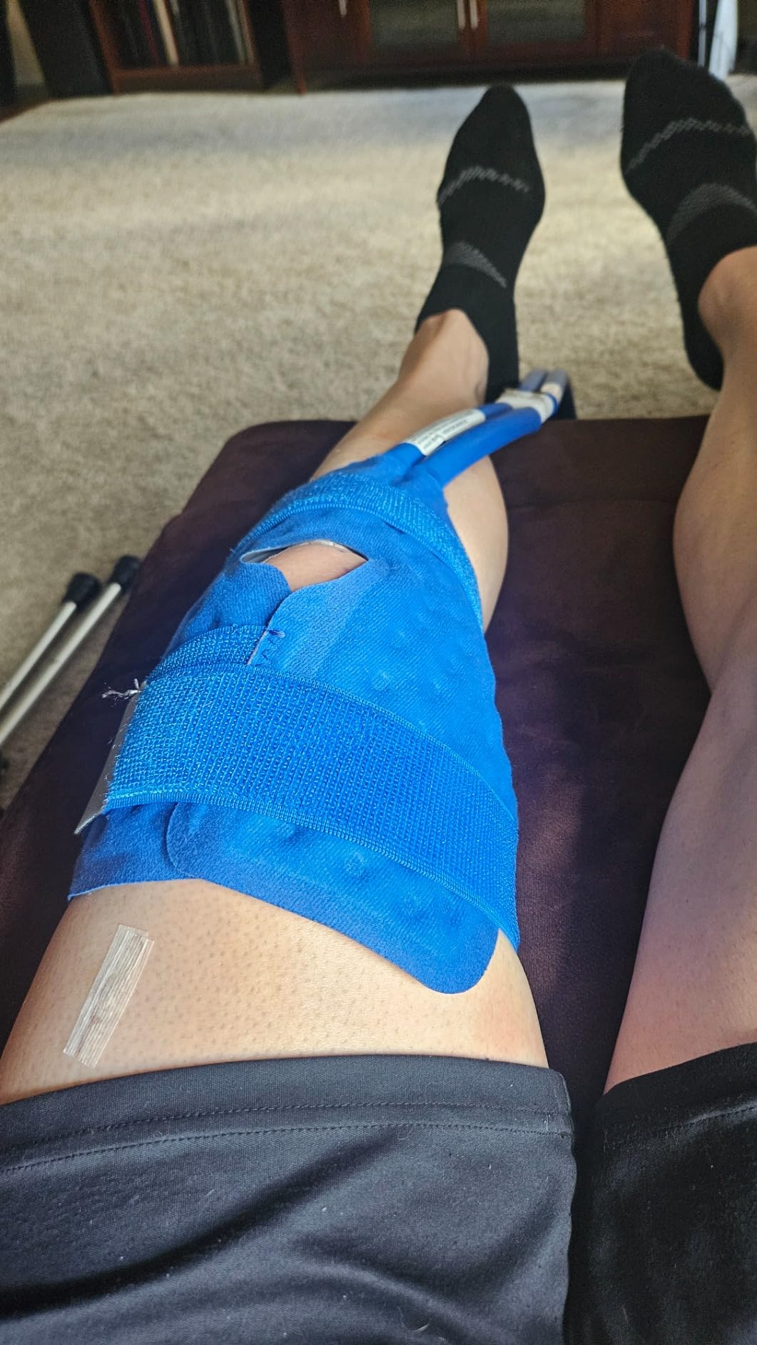 Polar Active Ice 3.0 | 9 QT Cold Therapy Ice Machine | Programmable Timer | Knee & Joint Pad | Cryotherapy Pain Relief System | Ace Bandage Style Compression customer photo 1