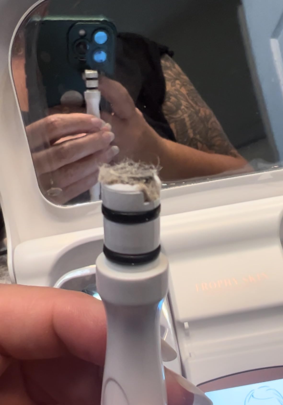 Trophy Skin MicrodermMD - At Home Microdermabrasion Kit - Anti Aging and Acne Treatment - Contains Real Diamond and Pore Extractor Tips to Rejuvenate Skin - White customer photo 2