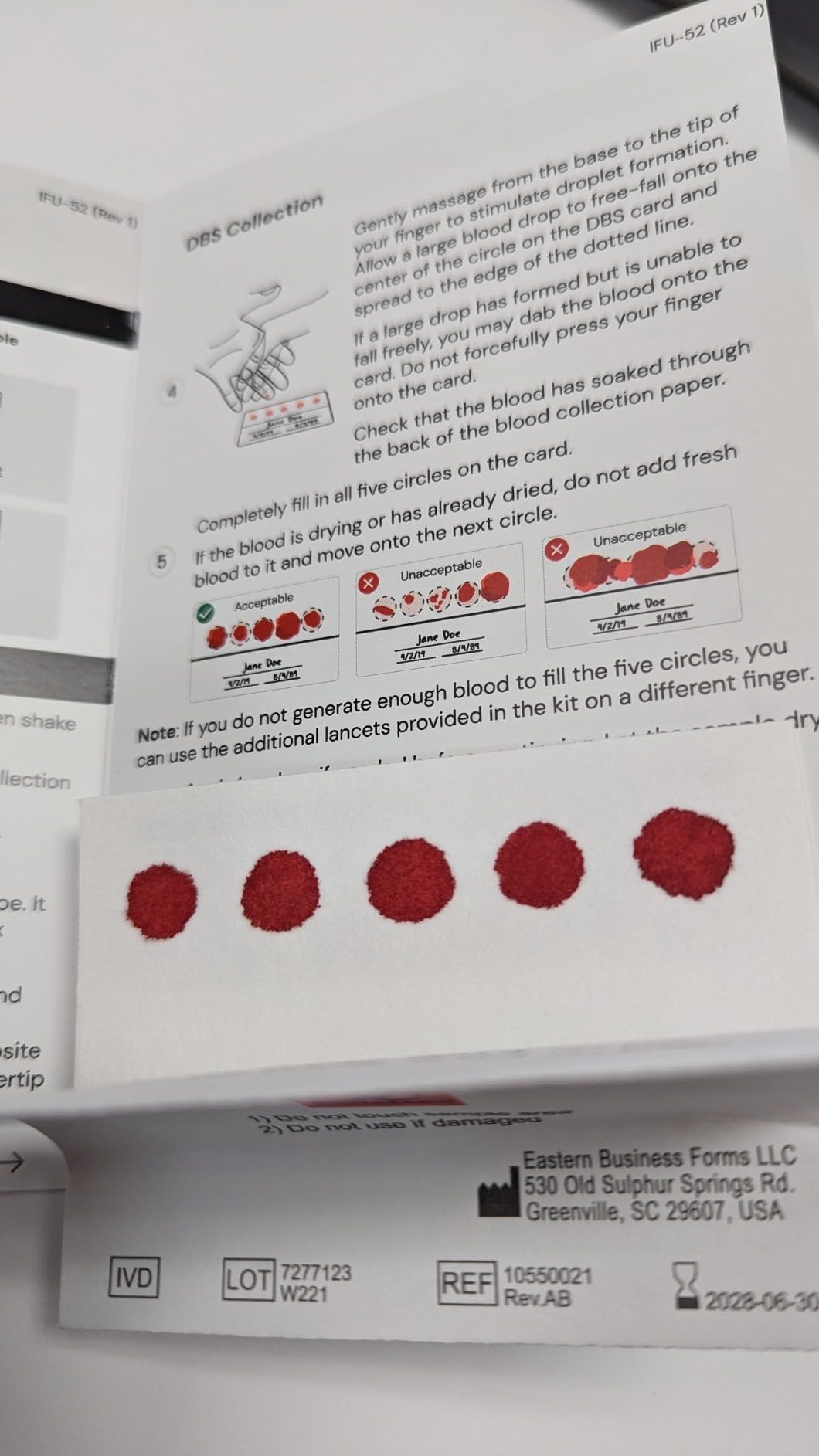 Simple HealthKit At-Home Diabetes Test Kit for Hemoglobin A1c (HbA1c) Levels - A1c Home Test Kit - Free Follow-Up Care & Fast Lab Results customer photo 1