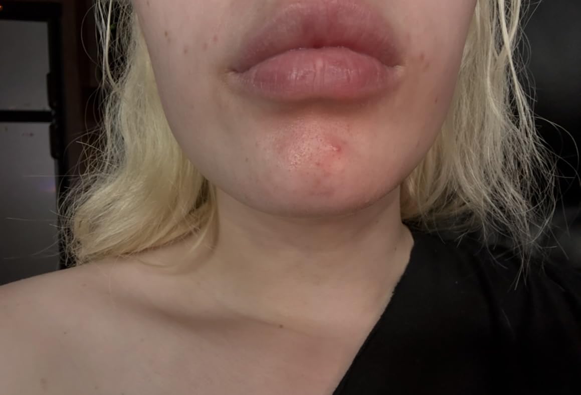 Paula's Choice SKIN PERFECTING 2% BHA Liquid Leave-On Exfoliant customer photo 2