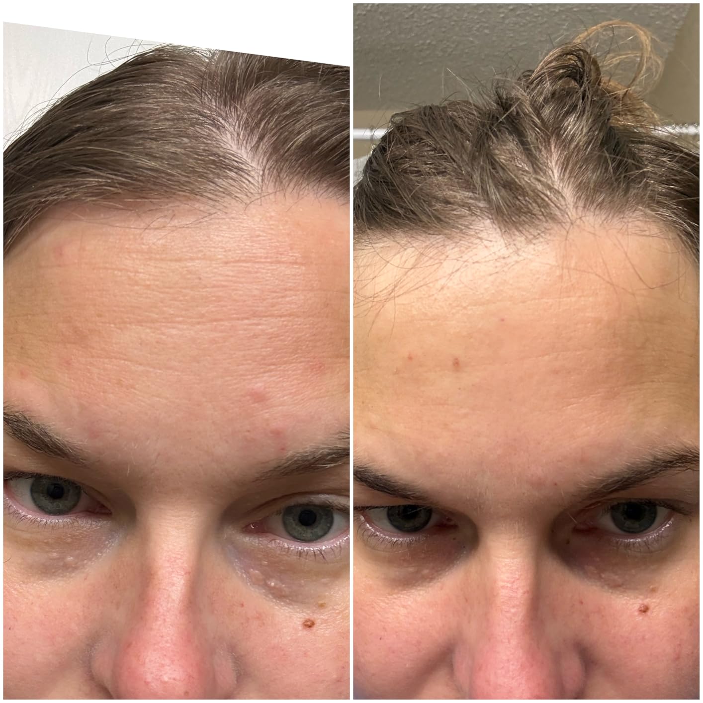 CeraVe Retinol Serum for Face with Niacinamide & Hyaluronic Acid customer photo 2