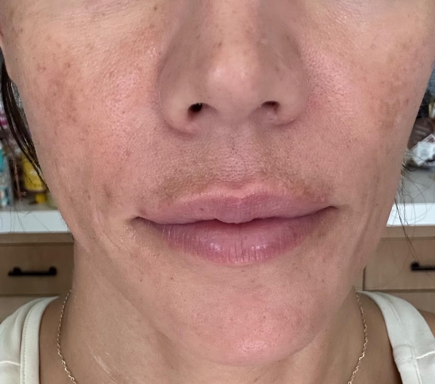 AXIS-Y Dark Spot Correcting Glow Serum - 5% Niacinamide Dark Spot Remover For Face - Vegan Korean Skin Care Niacinamide Serum for All Skin Types (1.69 fl. oz.) customer photo 1