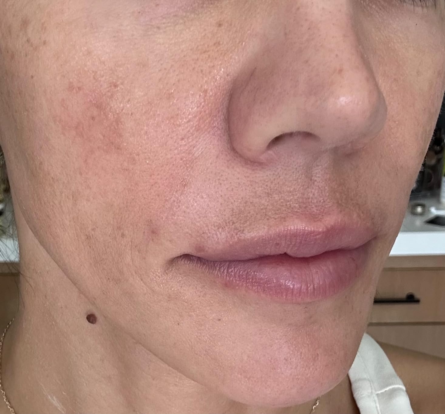 AXIS-Y Dark Spot Correcting Glow Serum - 5% Niacinamide Dark Spot Remover For Face - Vegan Korean Skin Care Niacinamide Serum for All Skin Types (1.69 fl. oz.) customer photo 2